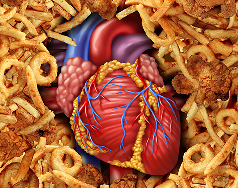 Heart Disease Food
